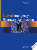 Atlas Of Emergency Neurovascular Imaging