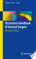 Illustrative Handbook Of General Surgery