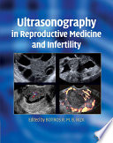 Ultrasonography In Reproductive Medicine And Infertility