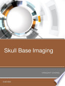 Skull Base Imaging