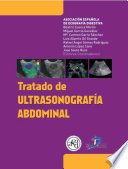 Tratado De Ultrasonograf A Abdominal