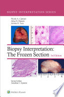 Biopsy Interpretation The Frozen Section