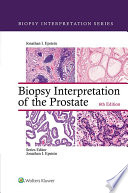 Biopsy Interpretation Of The Prostate