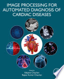 Image Processing For Automated Diagnosis Of Cardiac Diseases