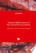 Vascular Malformations Of The Central Nervous System