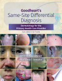 Goodheart S Same Site Differential Diagnosis