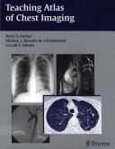 Read Pdf Teaching Atlas of Chest Imaging