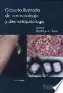 Glosario Ilustrado De Dermatolog A Y Dermatopatolog A