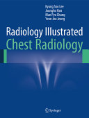 Radiology Illustrated Chest Radiology