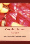 Vascular Access Simplified