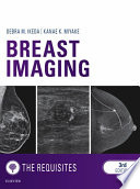 Breast Imaging The Requisites E Book