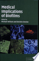 Medical Implications Of Biofilms