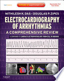Electrocardiography Of Arrhythmias A Comprehensive Review