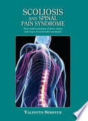 Scoliosis And Spinal Pain Syndrome