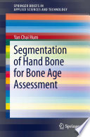 Segmentation Of Hand Bone For Bone Age Assessment