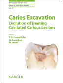Read Pdf Caries Excavation: Evolution of Treating Cavitated Carious Lesions