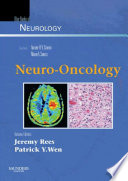 Neuro Oncology E Book