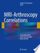 Mri Arthroscopy Correlations