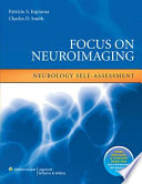 Focus On Neuroimaging