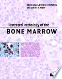 Illustrated Pathology Of The Bone Marrow