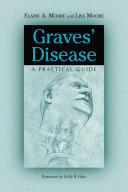 Read Pdf Graves’ Disease