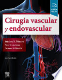 Cirug A Vascular Y Endovascular