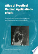 Atlas Of Practical Cardiac Applications Of Mri