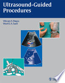 Ultrasound Guided Procedures