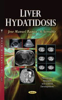Liver Hydatidosis