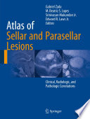 Atlas Of Sellar And Parasellar Lesions