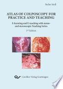 Atlas Of Colposcopy For Practice And Teaching