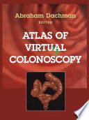 Atlas Of Virtual Colonoscopy
