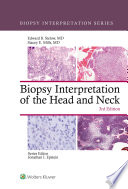 Biopsy Interpretation Of The Head And Neck