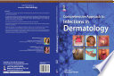 Comprehensive Approach To Infections In Dermatology