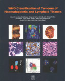 Who Classification Of Tumours Of Haematopoietic And Lymphoid Tissues