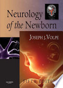 Neurology Of The Newborn E Book