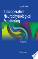 Intraoperative Neurophysiological Monitoring