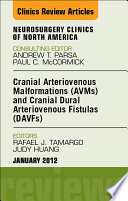 Cranial Arteriovenous Malformations Avms And Cranial Dural Arteriovenous Fistulas Davfs An Issue Of Neurosurgery Clinics E Book