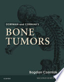 Dorfman And Czerniak S Bone Tumors E Book