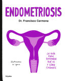 Endometriosis La Gu A Para Entender Qu Es Y C Mo Cuidarte