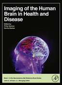 Read Pdf Imaging of the Human Brain in Health and Disease