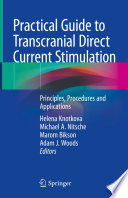 Practical Guide To Transcranial Direct Current Stimulation