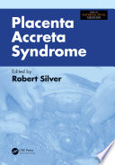 Placenta Accreta Syndrome book
