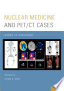 Nuclear Medicine And Pet Ct Cases