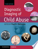 Diagnostic Imaging Of Child Abuse