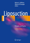 Read Pdf Liposuction