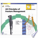 Ao Principles Of Fracture Management