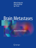 Read Pdf Brain Metastases