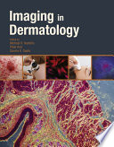 Imaging In Dermatology