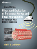 Read Pdf Ultrasound Evaluation of Peripheral Nerves and Focal Neuropathies, Second Edition
